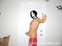 Tummy Tuck Weight Loss