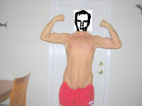 Body Lift Surgery Before Picture