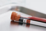 PT-PTT Blood Clotting Test; PT-PTT Blood Clotting Test - What is PT-PTT?