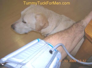 White Coat Hypertension