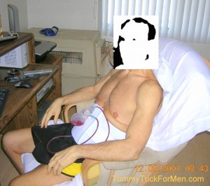 Sitting in chair the morning after my tummy tuck.